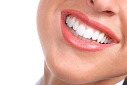 Ein Gebiss mit ansprechender Zahnästhetik