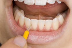 Gesunde Zähne dank regelmäßiger Vorsorgeuntersuchungen