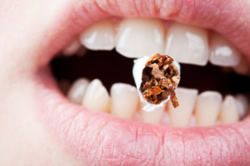 Rauchen als Gefahr von Zahnfleischerkrankungen