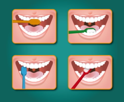 Richtig Zähneputzen in vier Schritten