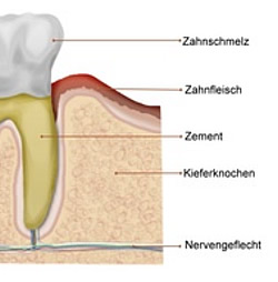 Zahnzement in der schematischen Darstellung eines Backenzahns im Querschnitt